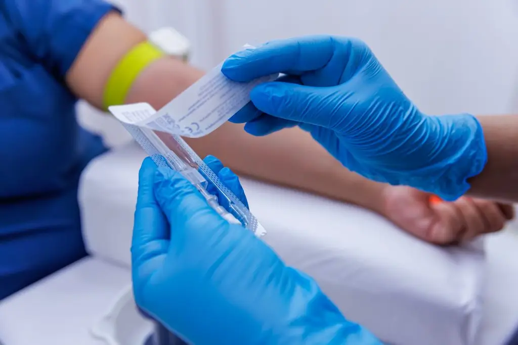 A patient with serum administered in the hospital. Serum is given to the patient. The serum that the nurse makes to her patient. While the doctor opens a vascular access to the patient.